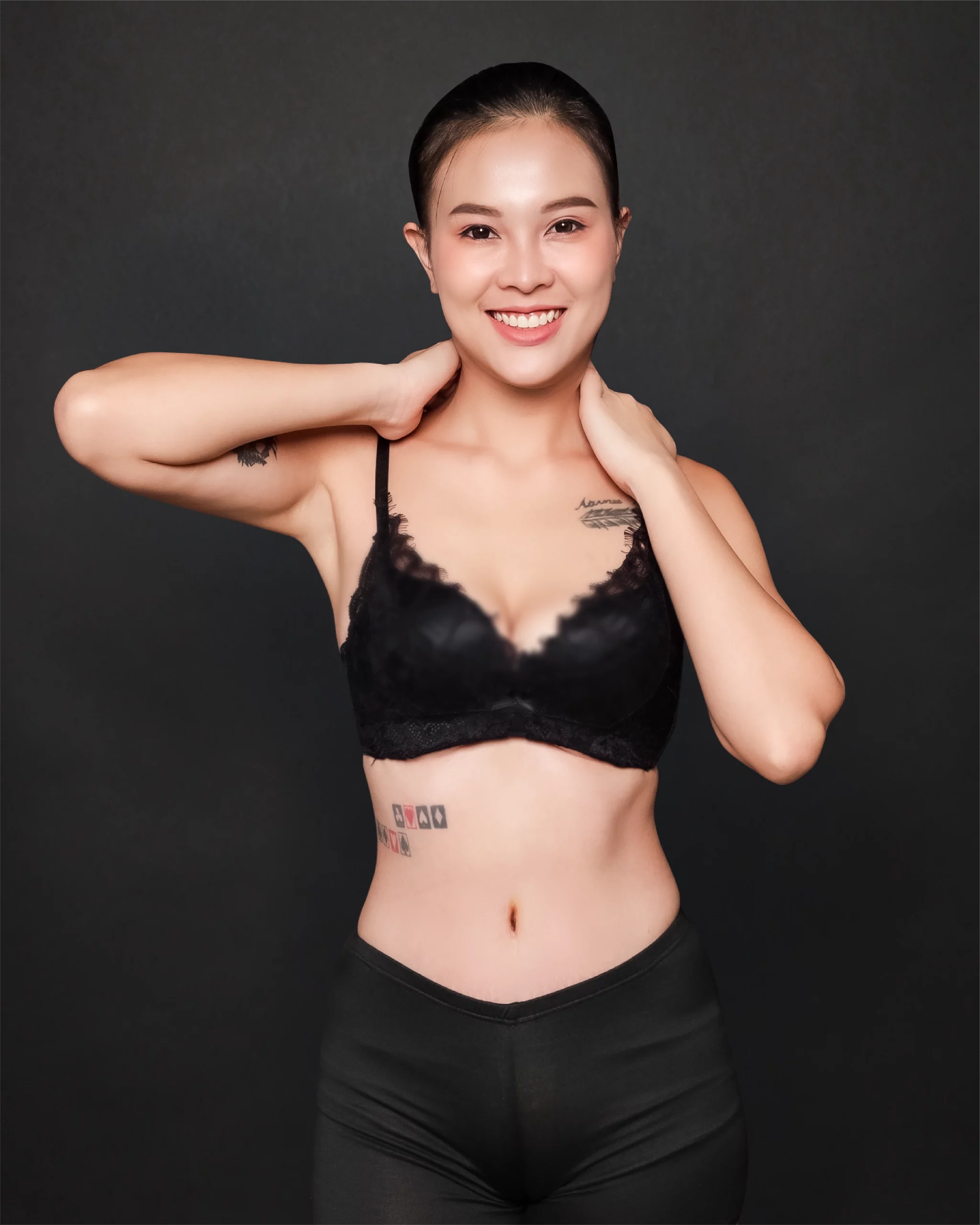 1.เคสตัดหนังหน้าท้อง