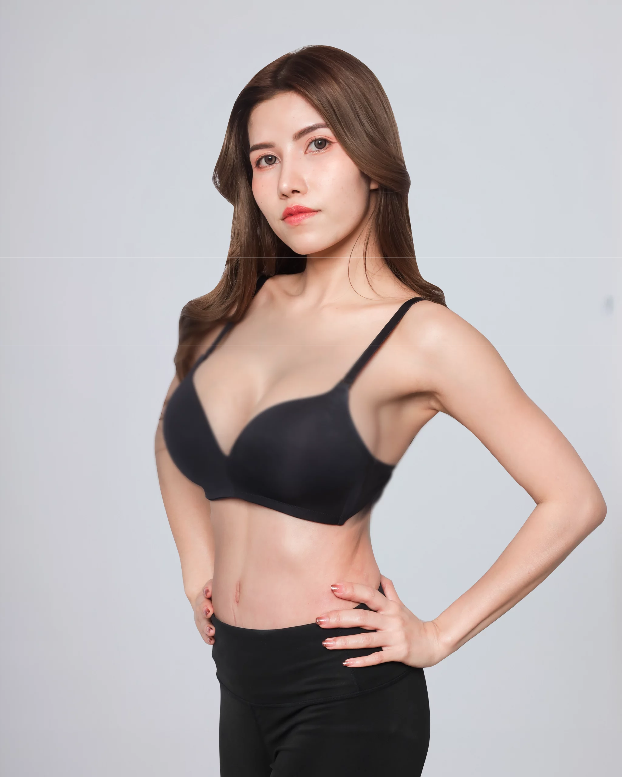 10.เคสตัดหนังหน้าท้อง